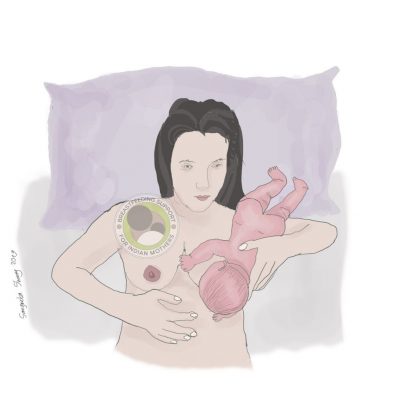 C- Section Nursing (4) C- Section Nursing (4)