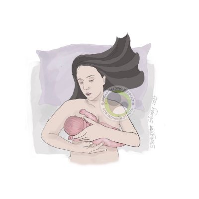 C- Section Nursing C- Section Nursing